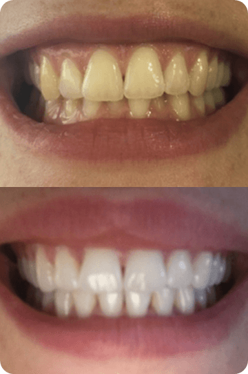 Harriet's real results