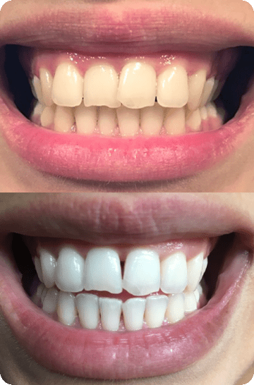 Laura's real results