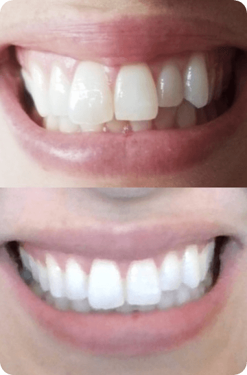 Catherine's real results