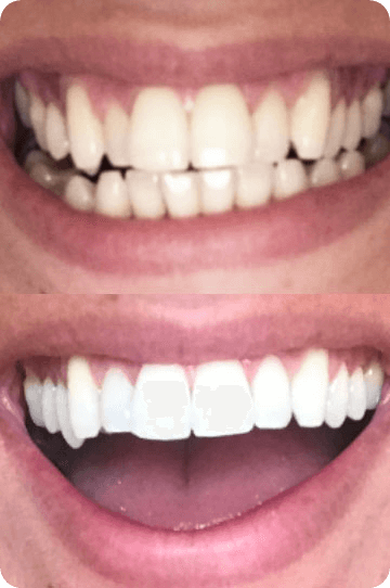 Mrs Swinfen Green's real results